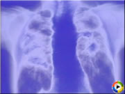 粉じんによる疾病の防止　サンプル映像